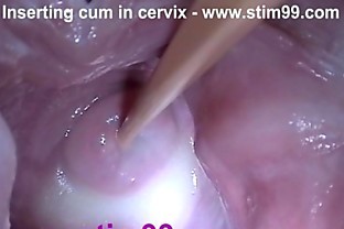 Insertion Semen Cum in Cervix Wide Stretching Pussy Speculum