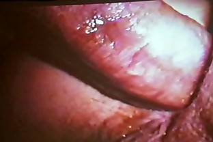 Hairy butthole spread open